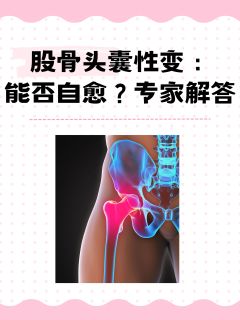 股骨头囊性变：能否自愈？专家解答