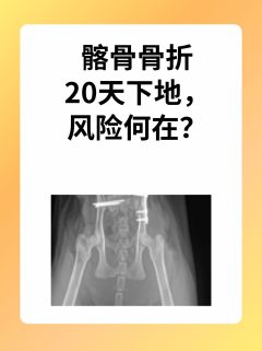 髂骨骨折20天下地，风险何在？