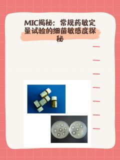 常规药敏定量试验MIC是查什么？