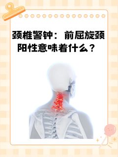 颈椎警钟：前屈旋颈阳性意味着什么？