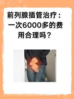 前列腺插管治疗：一次6000多的费用合理吗？