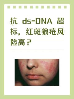 抗ds-DNA超标，红斑狼疮风险高？