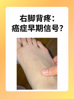 右脚背疼：癌症早期信号？