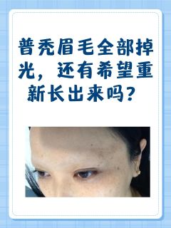 普秃眉毛全部掉光，还有希望重新长出来吗？