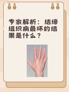 专家解析：结缔组织病最坏的结果是什么？