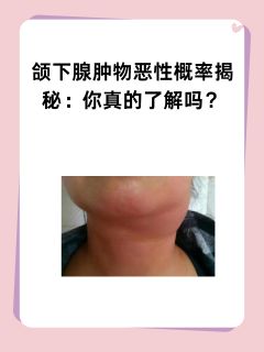 颌下腺肿物恶性概率揭秘：你真的了解吗？