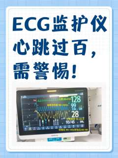 ECG监护仪心跳过百，需警惕！