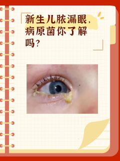 新生儿脓漏眼，病原菌你了解吗？