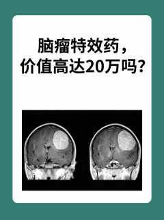 脑瘤特效药，价值高达20万吗？