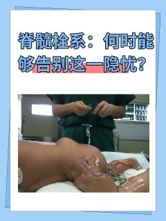 脊髓栓系：何时能够告别这一隐忧？