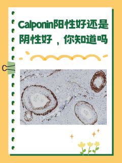 Calponin阳性好还是阴性好，你知道吗