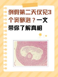 例假第二天仅见3个窦卵泡？一文带你了解真相