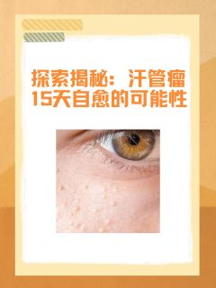 探索揭秘：汗管瘤15天自愈的可能性