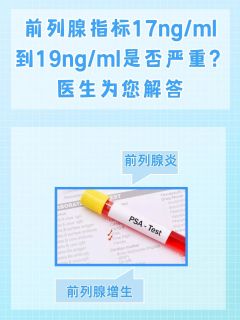 前列腺指标17-19ng/ml是否严重？