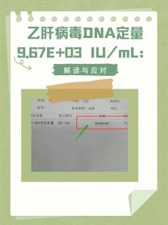 乙肝病毒DNA定量9.67e+03 IU/mL：解读与应对