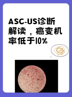 ASC-US诊断解读，癌变机率低于10%