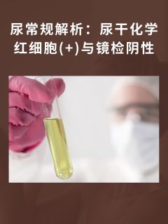 尿常规解析：尿干化学红细胞(+)与镜检阴性