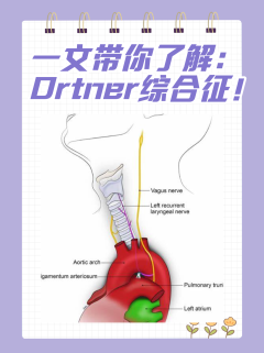 一文带你了解：Ortner综合征！