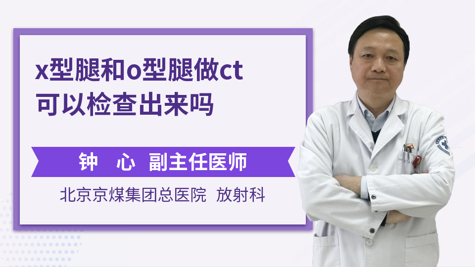 x型腿和o型腿做ct可以检查出来吗